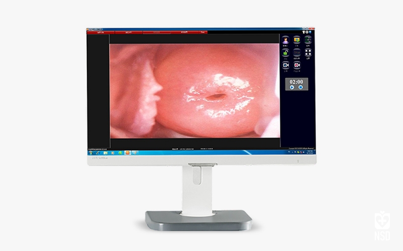 دستگاه کولپوسکوپ چشمی مدل KN-2200 B